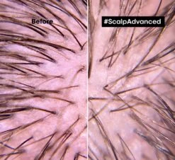 L’Oréal Professionnel Serie Expert Scalp Advanced -Beauté Cheveux Soldes loreal professionnel serie expert scalp advanced shampoing pour cuir chevelu sensible et irrite 1